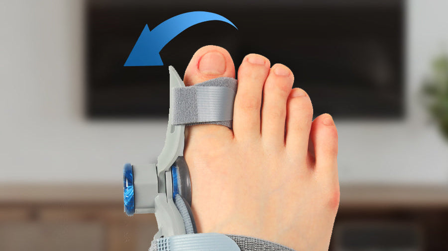 Say Goodbye to Bunion Pain: Why This Adjustable Bunion Corrector Is a Must-Have in 2025