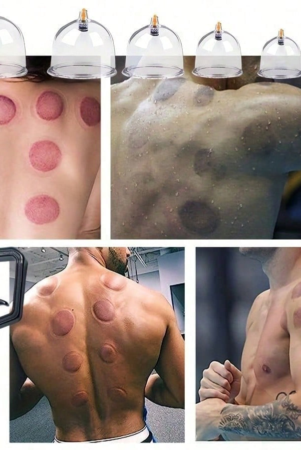 Vacuum Cupping Device/18 Cups + Electroplating Gun - Sweat Absorber - detail view