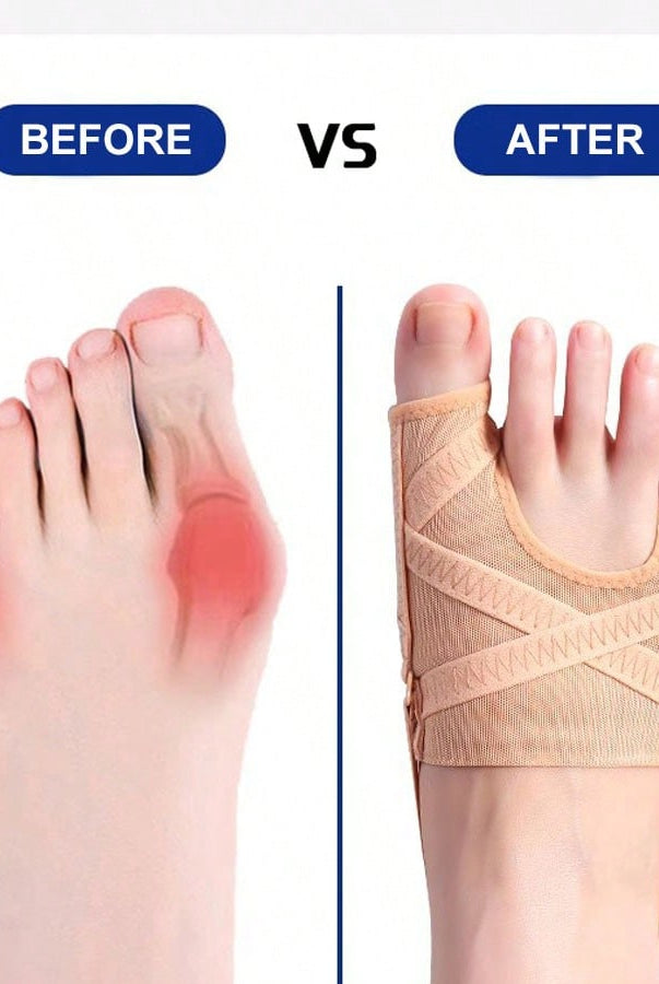 1 Pc Bunion Corrector - Adjustable Big Toe And Tail Toe Separator - side view