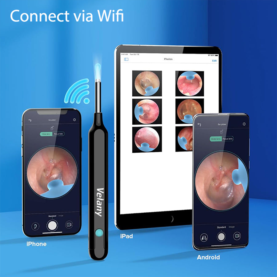 Ear Cleaner with Camera & Light - WiFi Visual Ear Wax Removal Tool Kit for iPhone & Android | Velany - view 1 of 3