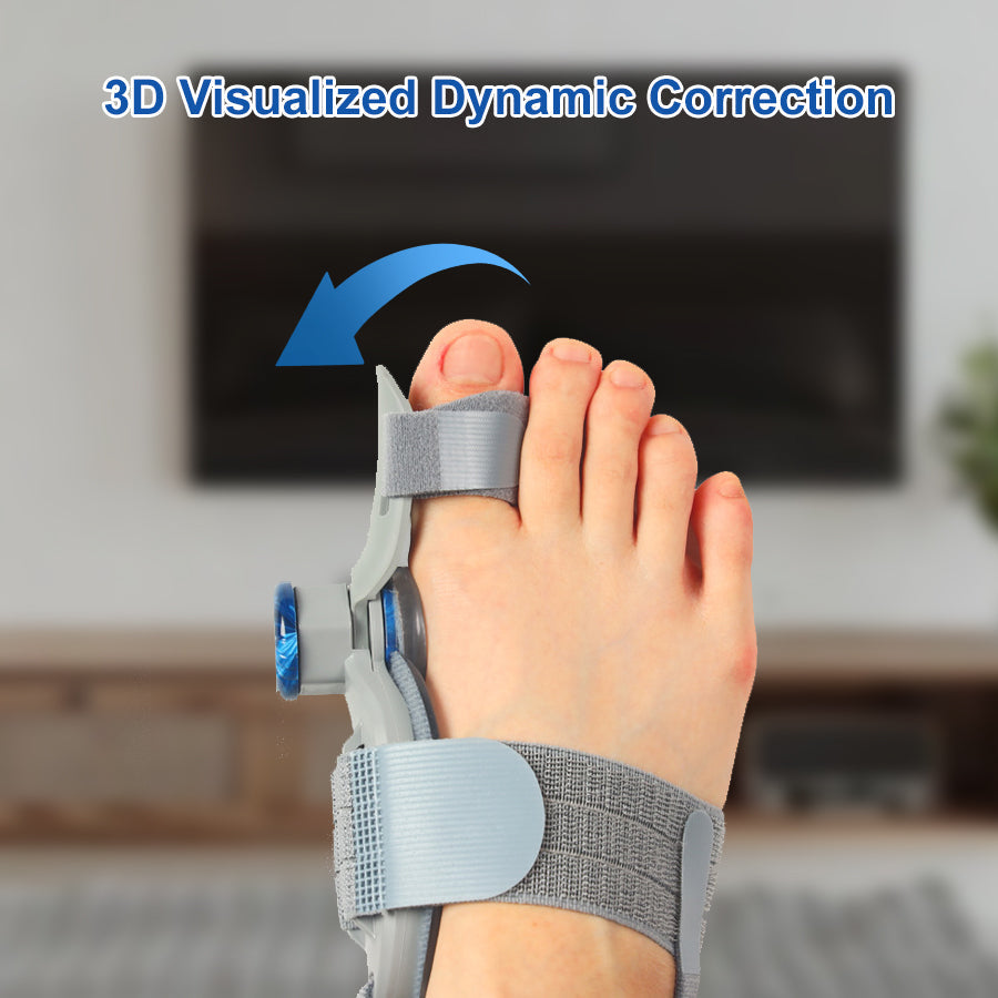 Say Goodbye to Bunion Pain: Why This Adjustable Bunion Corrector Is a Must-Have in 2025