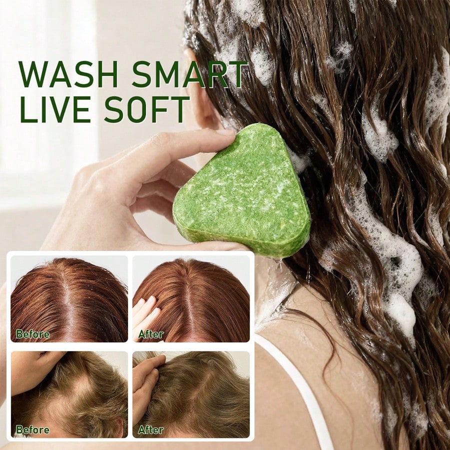 Anti Hair Loss Shampoo Bar DHT Blocker With Polygonum Ginseng Tea Tree Extracts Strengthens Roots Reduces Hair Fall For Thinning Hair Sulfate-Free Herbal Hair Growth Soap 120g*3 Pack For Men Women Hair Care - view 2 of 7