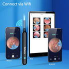 Ear Cleaner with Camera & Light - WiFi Visual Ear Wax Removal Tool Kit for iPhone & Android | Velany - view 1 of 3